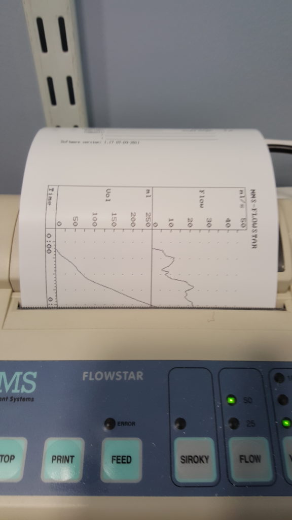A graphing printer describes Dan Q's urine flow. The 'flow rate' graph shows an initial peak, then a trough, then continues to a higher sustained peak.