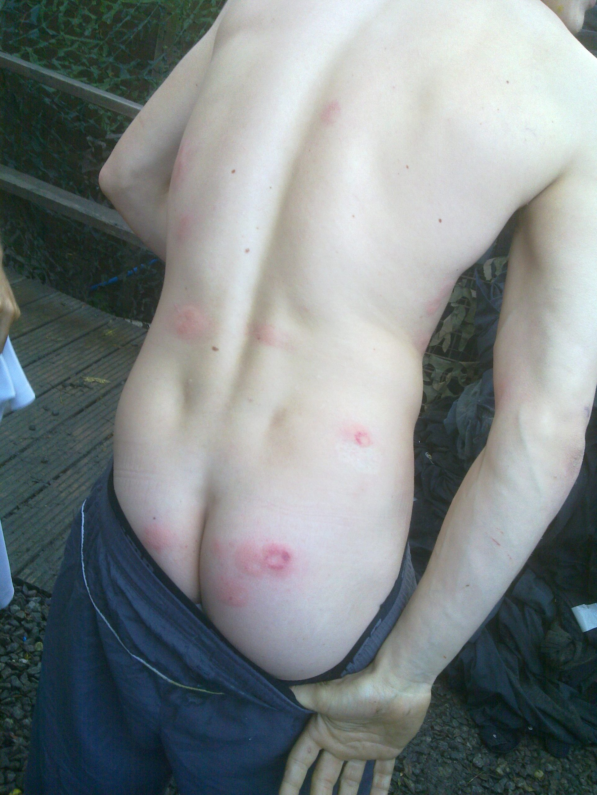 Full image of A bruised bottom.