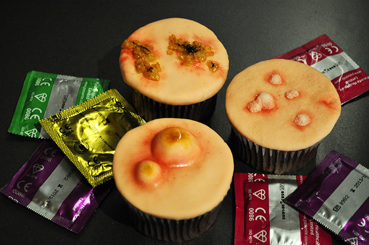 STD cupcakes