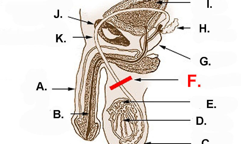 The "F" is for "Fuck me you're going to put a scalpel WHERE?"
