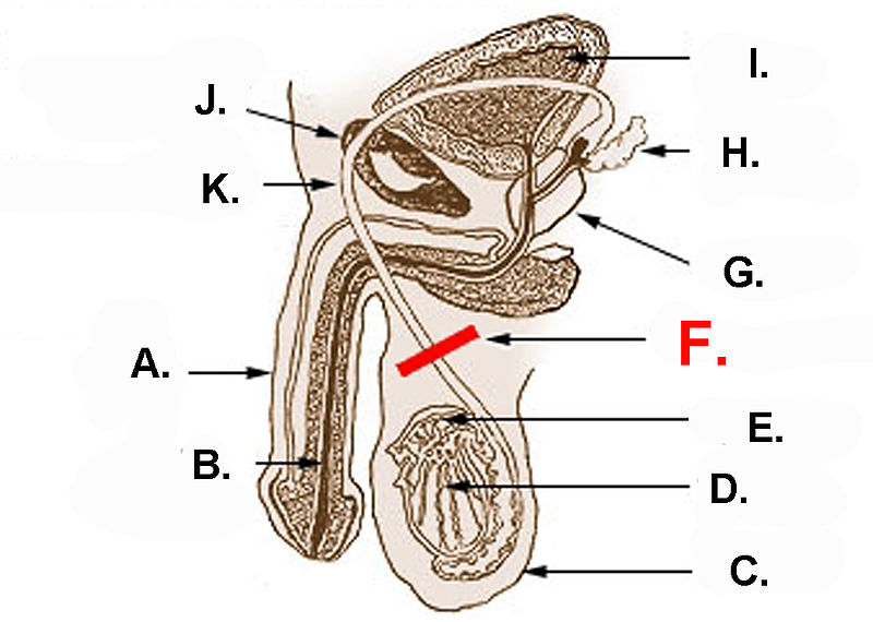 Full image of The "F" is for "Fuck me you're going to put a scalpel WHERE?"