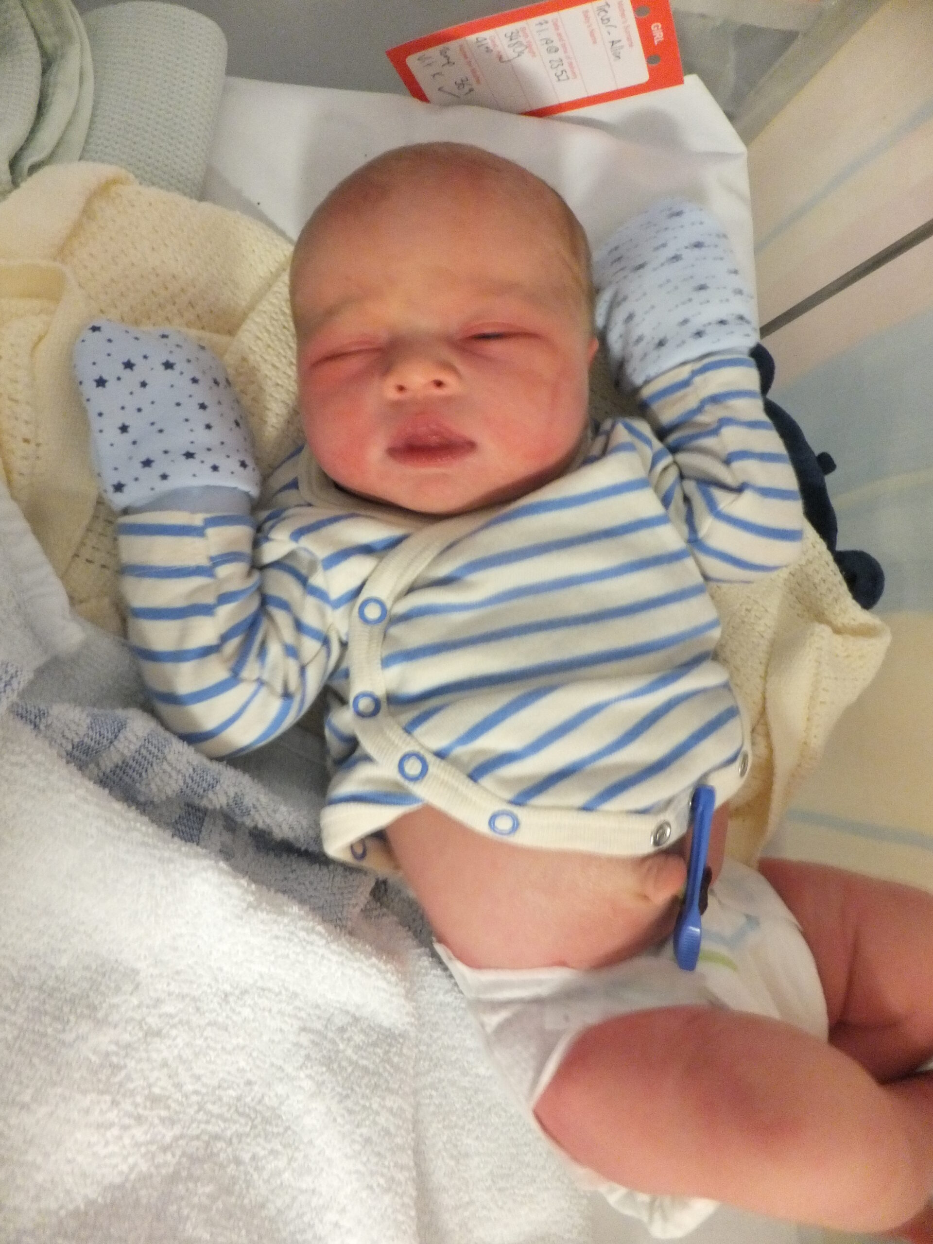 Full image of Forcep-marks still visible, the newborn takes an extended nap in a crib alongside Ruth's recovery-bed.
