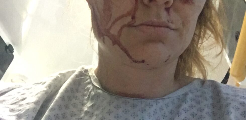 Image representing post: There’s Really No Easy Way to Say 'I Was Stabbed'