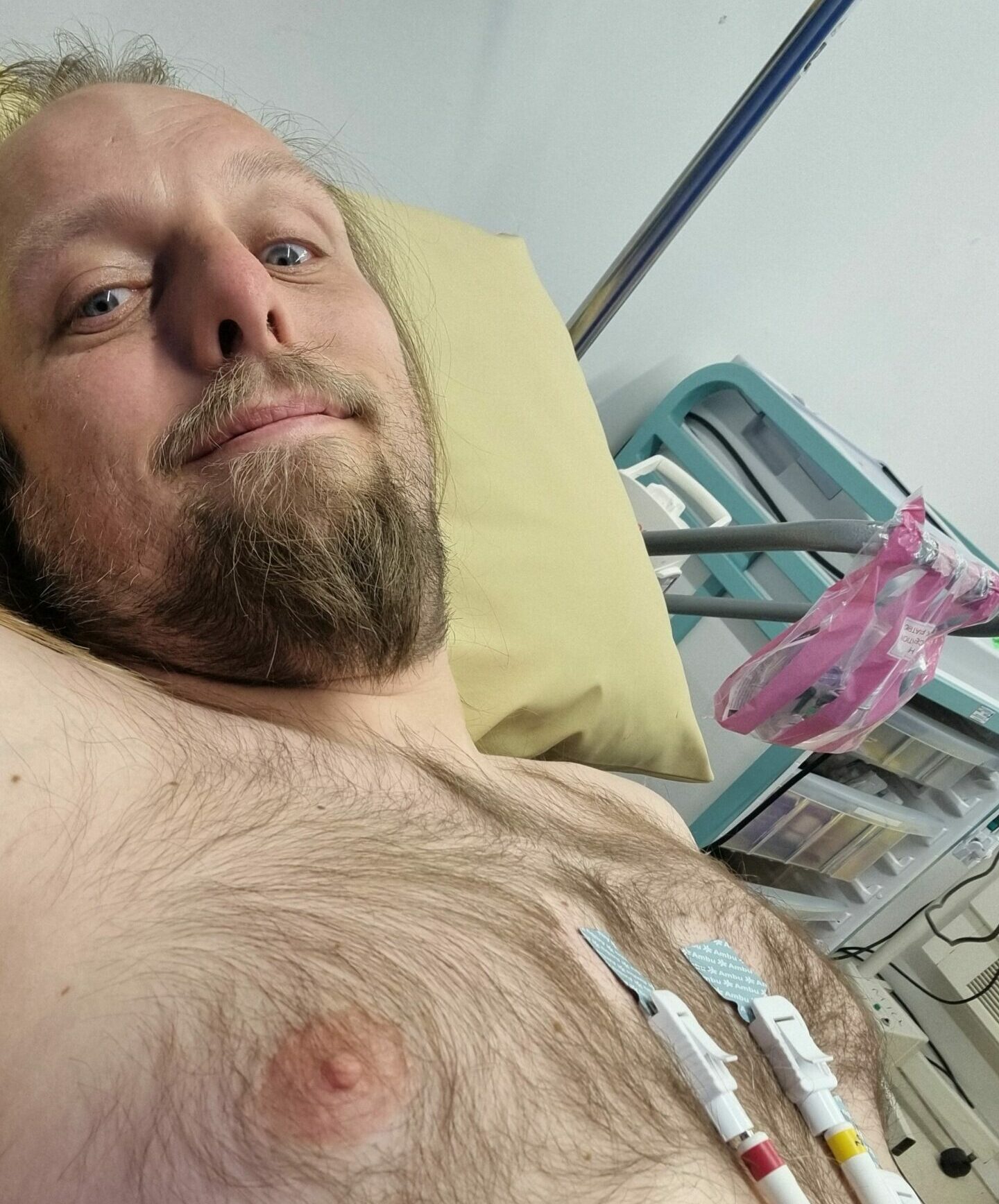 Full image of Dan, bare-chested, lies in a hospital bed with an ECG hooked-up to him.