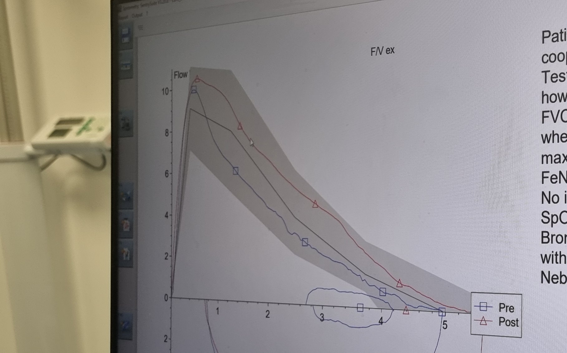 Full image of Computer screen graphs showing peak respiratory flow under a series of different experiments.