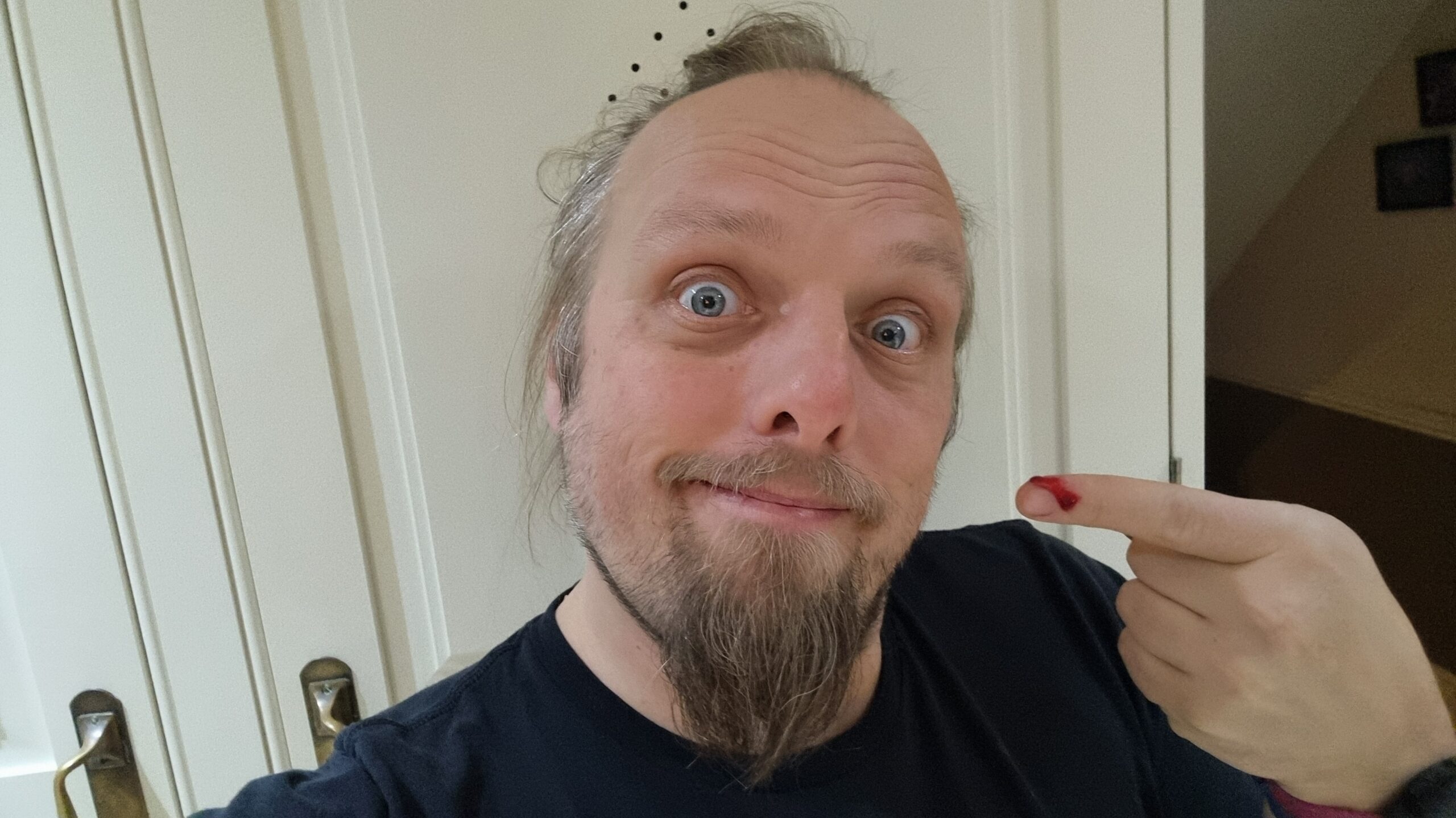 Full image of Dan stares into the camera, pointing to himself with the first finger of his left hand, which is pouring blood from a deep laceration.